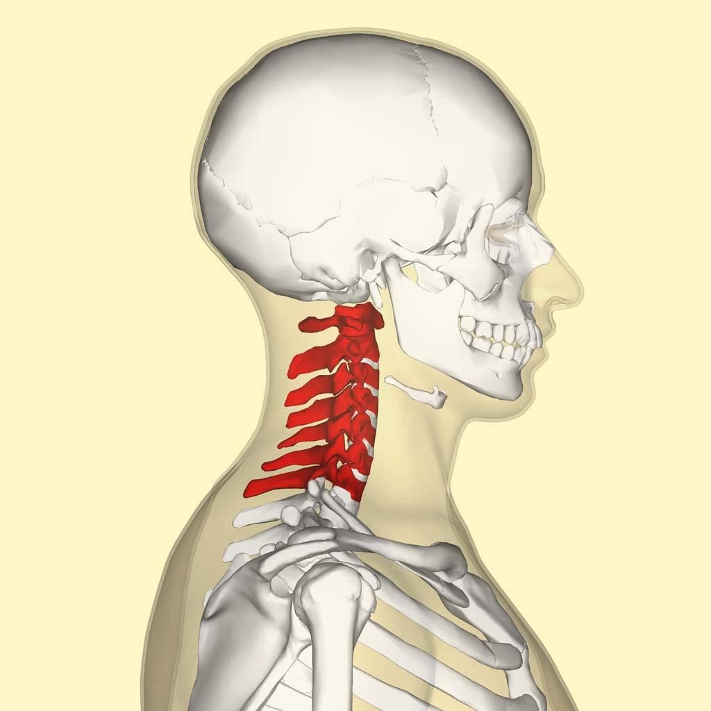 Cervical Radiculopathy